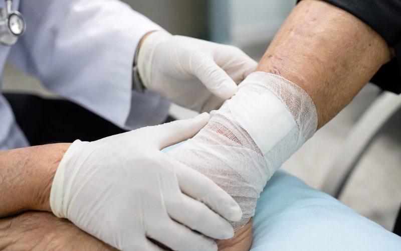 Preventing Infection Is Essential for Recovery