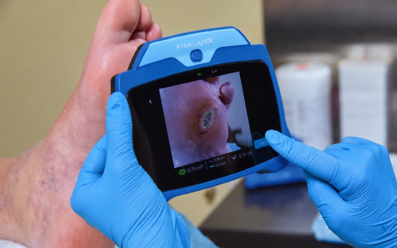 Advanced Wound Care Technology for Better Healing
