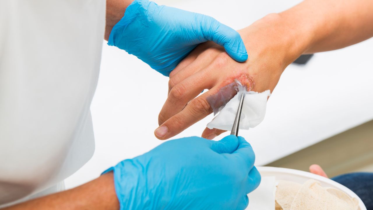 Top Southern California Locations for Mobile Wound Care