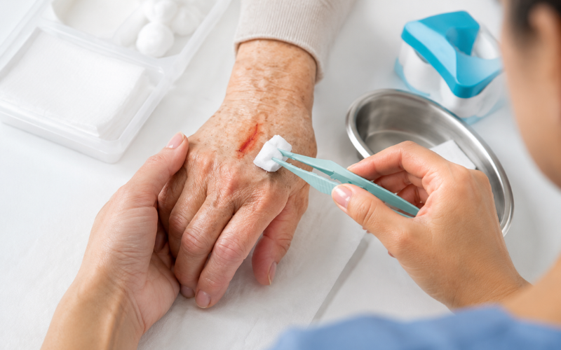 Wound care specialist providing in-home treatment for a patient with a chronic wound in Orange County
