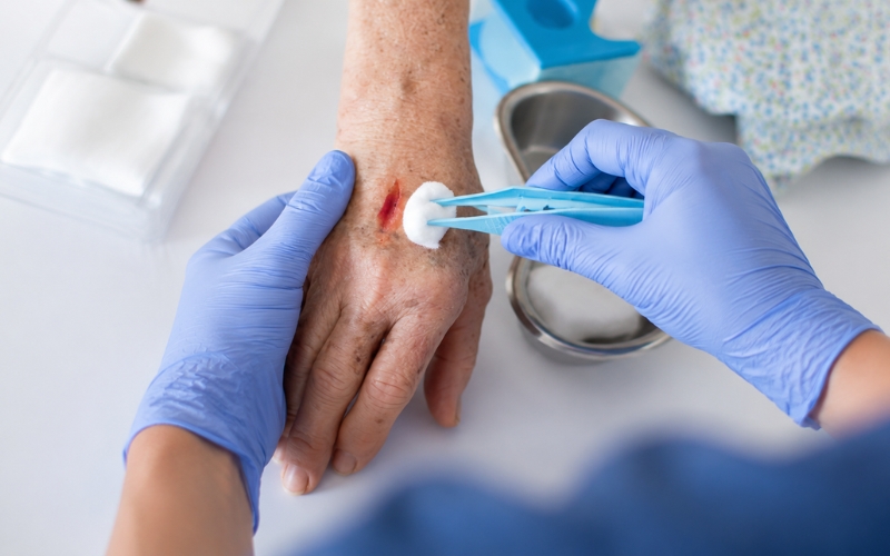 Wound care specialist performing wound assessment and treatment during an in-home visit in Westminster, CA