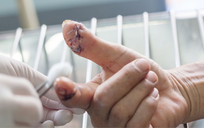 Professional Wound Care for Safe and Effective Healing