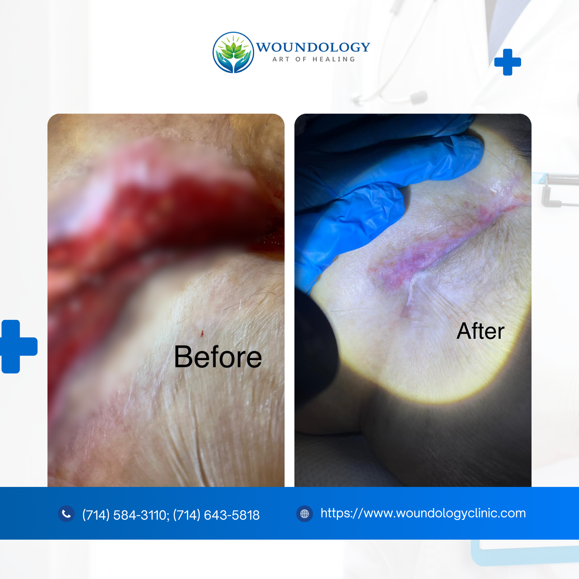 Patient Recovery Journey with Woundology