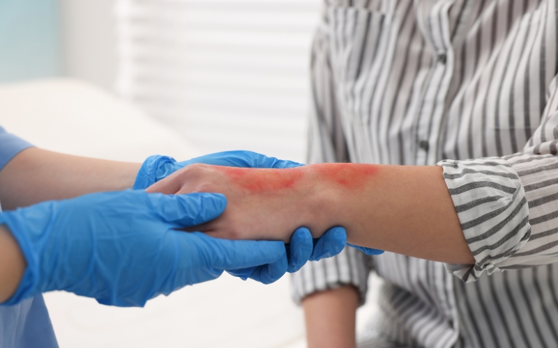 Mobile Wound Care for Patients in Santa Ana and Orange County