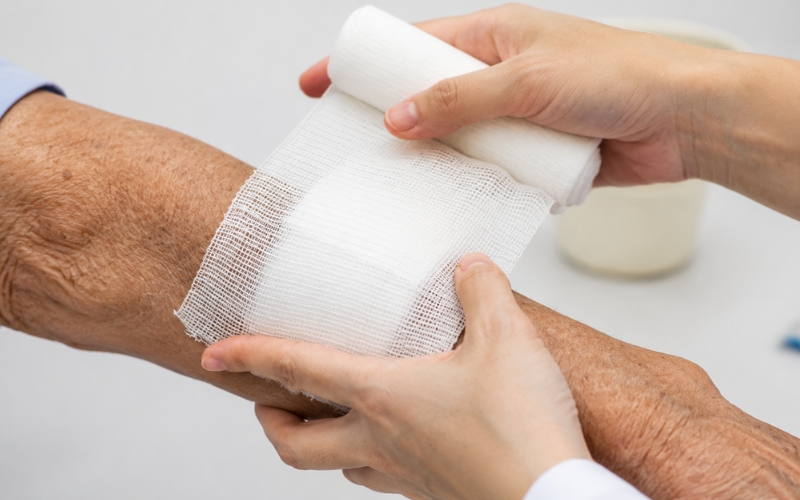 Mobile wound care specialist providing in-home treatment for a patient in Anaheim