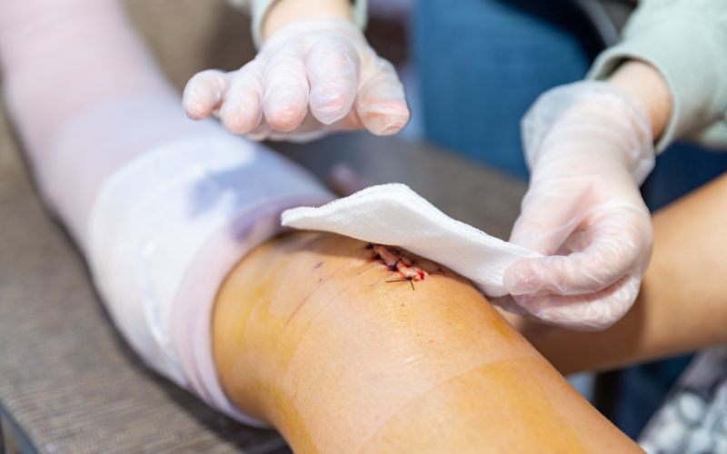 Home wound care helps wounds heal faster