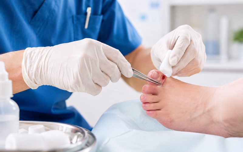 Healthcare professional performing open wound care on a patient's leg