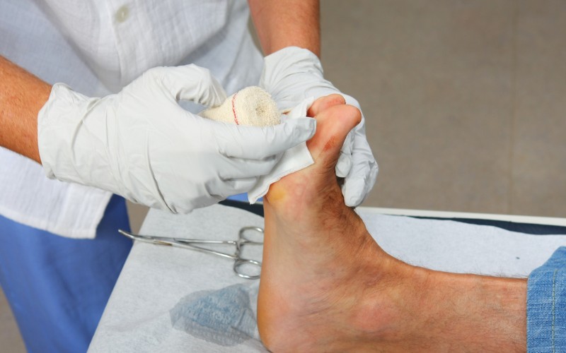 Mobile wound care specialist treating patient at home