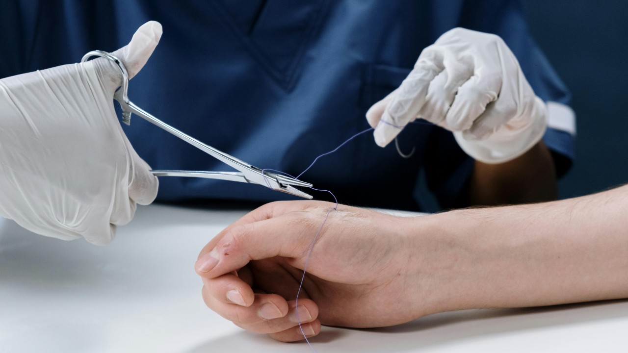 Advanced Wound Care in Glendora