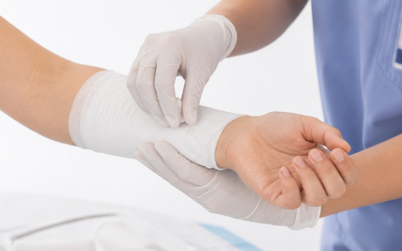 Understanding Wound Odor: A Critical Sign in Wound Healing